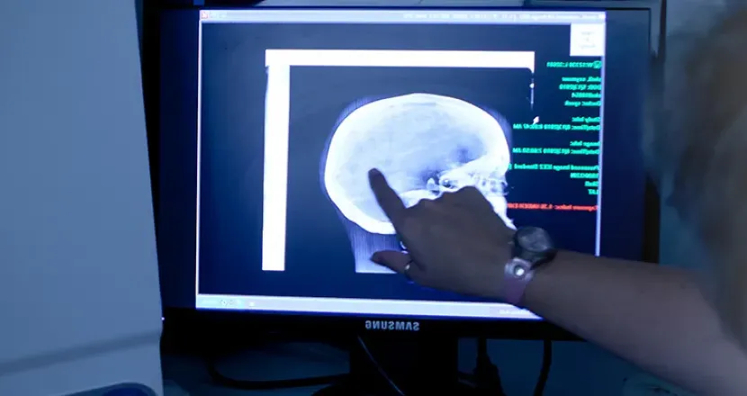 Radiology Tech in 佛罗里达 Examining X-Ray